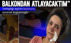 "Canımın acısıyla balkondan atlayacaktım!"