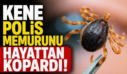 Kene polis memurunu hayattan kopardı