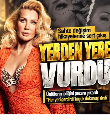 "HER YERİ GERDİRDİ"