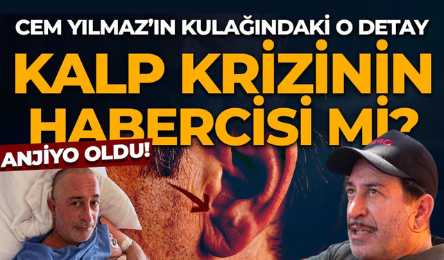 Cem Yılmaz’ın kalp krizi sonrası o detay gündem oldu!
