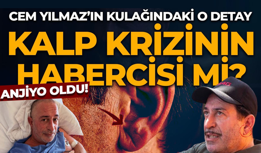 Cem Yılmaz’ın kalp krizi sonrası o detay gündem oldu!